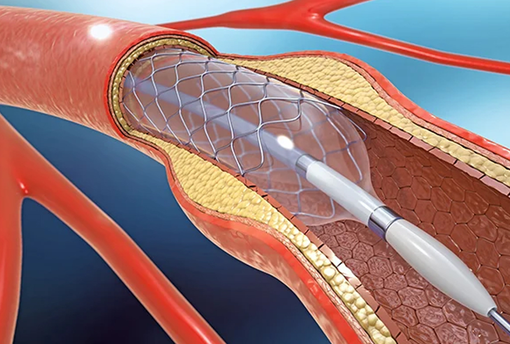 best hospital in jaipur|Gadhwal Heart & General Hospital