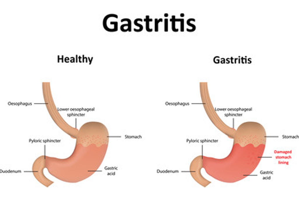 best hospital in jaipur|Gadhwal Heart & General Hospital