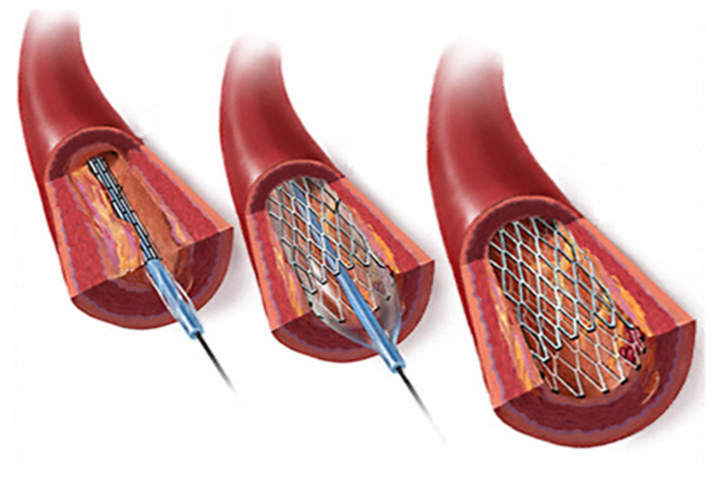 best hospital in jaipur|Gadhwal Heart & General Hospital